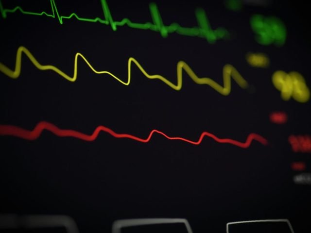 ECG