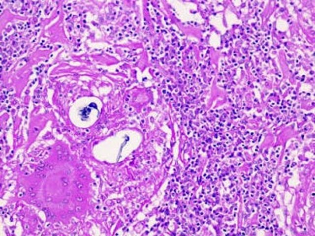 Histology