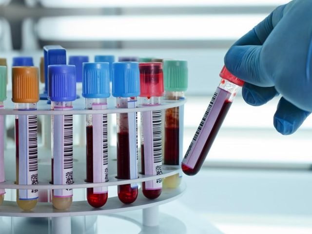 Immunoassay & Special Chemistry