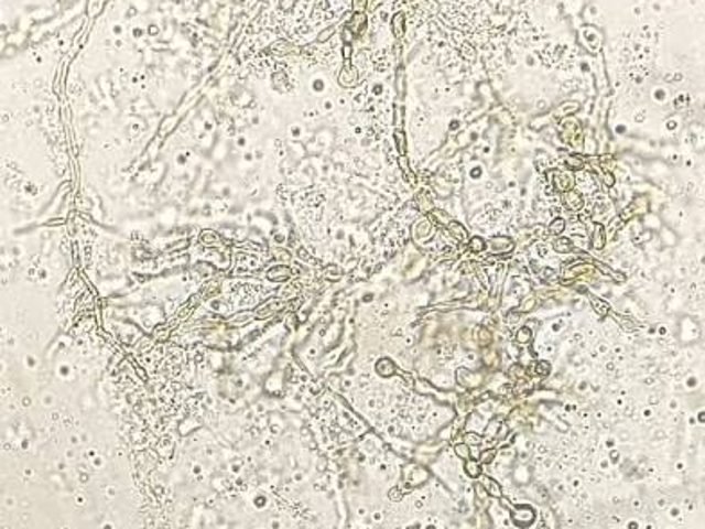 Mycology