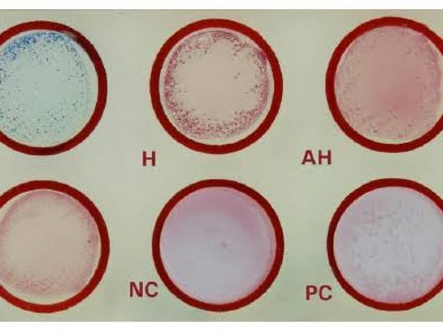 Serology